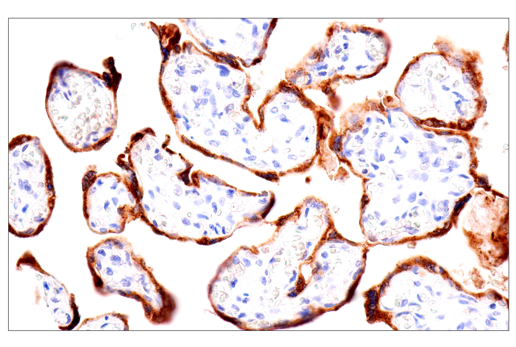 Immunohistochemistry Image 1: GDF15/MIC1 (E5Q8Q) Rabbit mAb