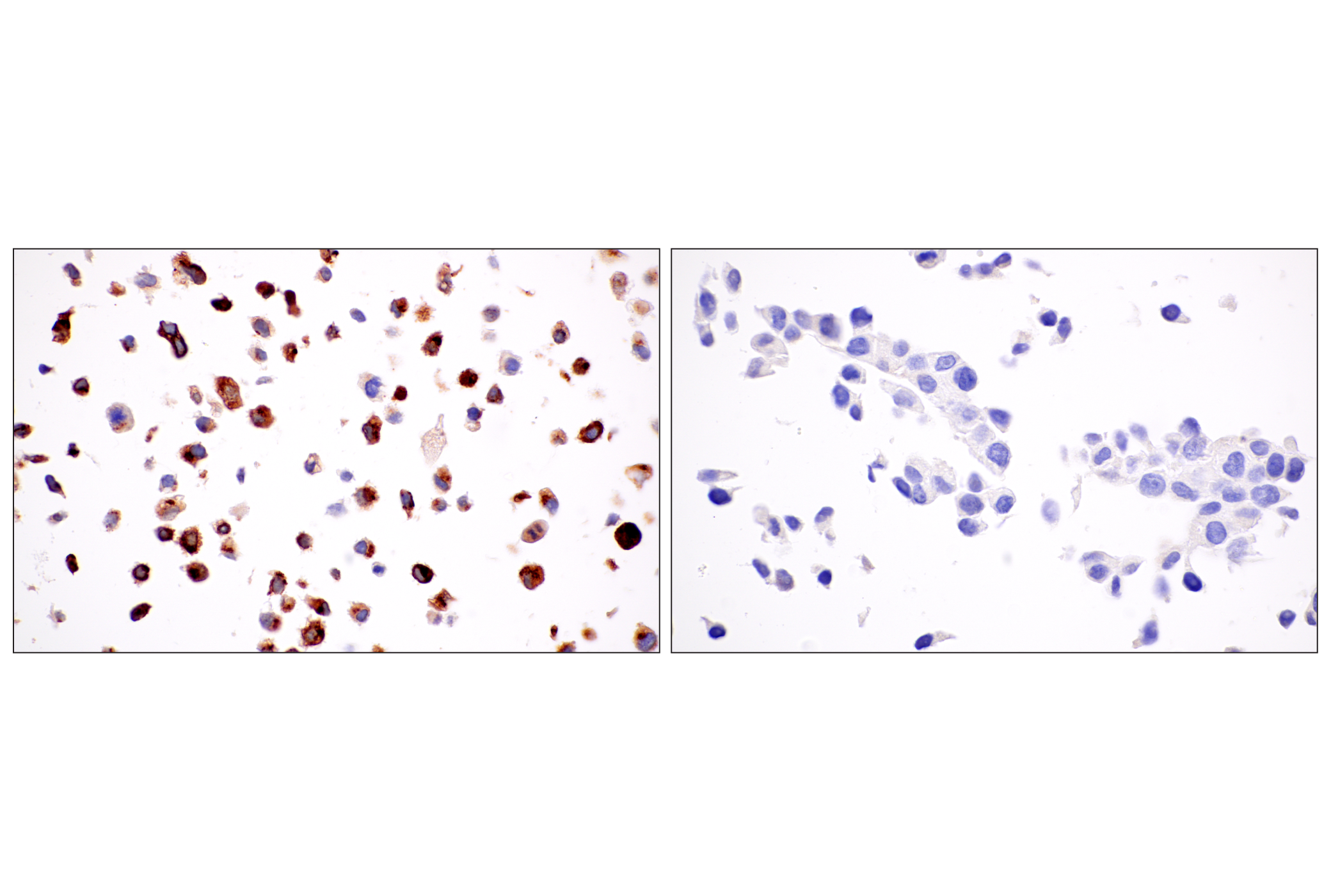 Immunohistochemistry Image 7: GDF15/MIC1 (E5Q8Q) Rabbit mAb