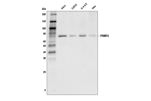  Image 9: PRMT Antibody Sampler Kit