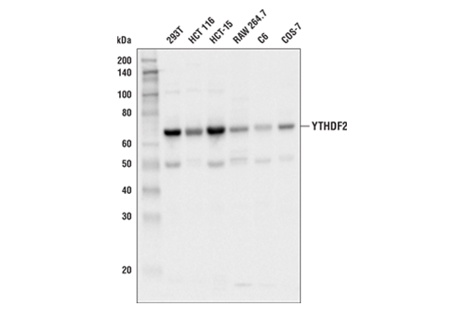 Western Blotting Image 1: YTHDF2 Antibody