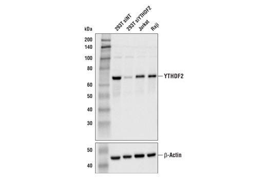 Western Blotting Image 2: YTHDF2 Antibody