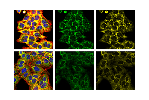 Immunofluorescence Image 1: YTHDF2 Antibody