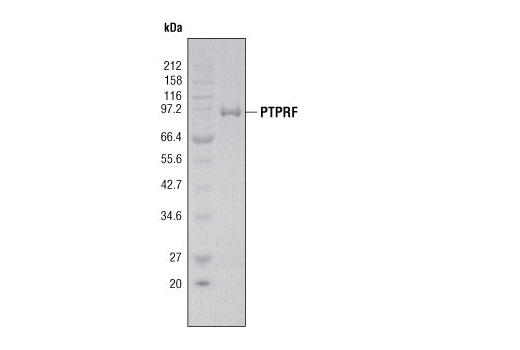  Image 2: PTPRF Phosphatase