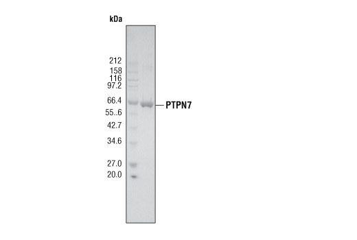  Image 2: PTPN7 Phosphatase