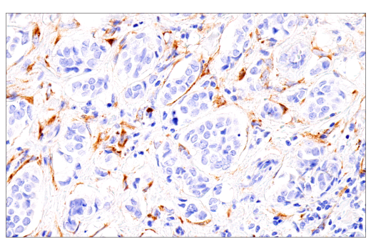 Immunohistochemistry Image 2: COL5A1 (E6U9W) Rabbit mAb (BSA and Azide Free)