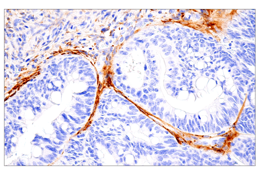 Immunohistochemistry Image 3: COL5A1 (E6U9W) Rabbit mAb (BSA and Azide Free)