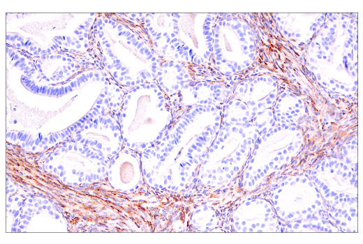 Immunohistochemistry Image 5: COL5A1 (E6U9W) Rabbit mAb (BSA and Azide Free)