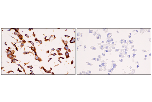 Immunohistochemistry Image 9: COL5A1 (E6U9W) Rabbit mAb (BSA and Azide Free)