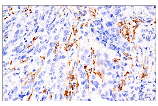 Immunohistochemistry Image 1: COL5A1 (E6U9W) Rabbit mAb (BSA and Azide Free)