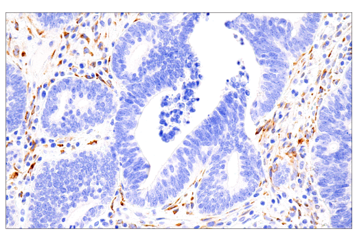 Immunohistochemistry Image 4: COL5A1 (E6U9W) Rabbit mAb (BSA and Azide Free)