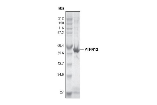  Image 2: PTPN13 Phosphatase