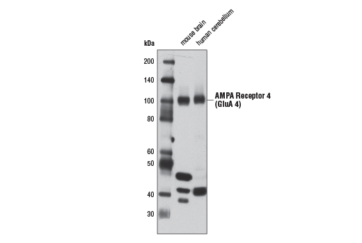 Western Blotting Image 1: AMPA Receptor 4 (GluA 4) (D19G9) Rabbit mAb