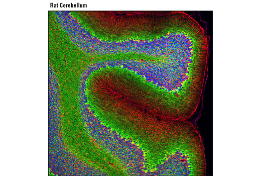 Immunofluorescence Image 1: Neurofilament-L (C28E10) Rabbit mAb (Alexa Fluor® 488 Conjugate)