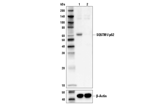  Image 6: Sequestosome Signaling Antibody Sampler Kit