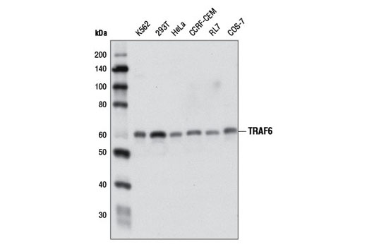  Image 12: Sequestosome Signaling Antibody Sampler Kit