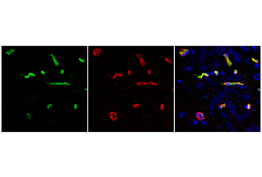 Immunofluorescence Image 2: Mfsd2a (E8U2O) Rabbit mAb