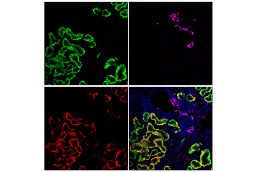 Immunofluorescence Image 3: Mfsd2a (E8U2O) Rabbit mAb