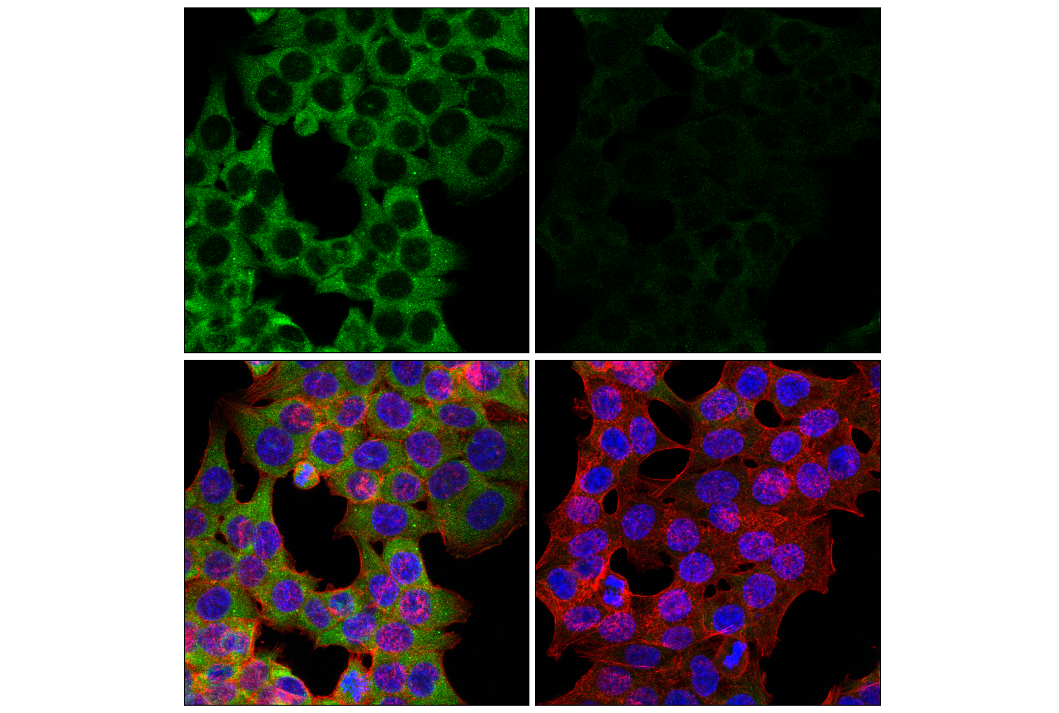 Immunofluorescence Image 4: YTHDF3 (E2J9I) Rabbit mAb