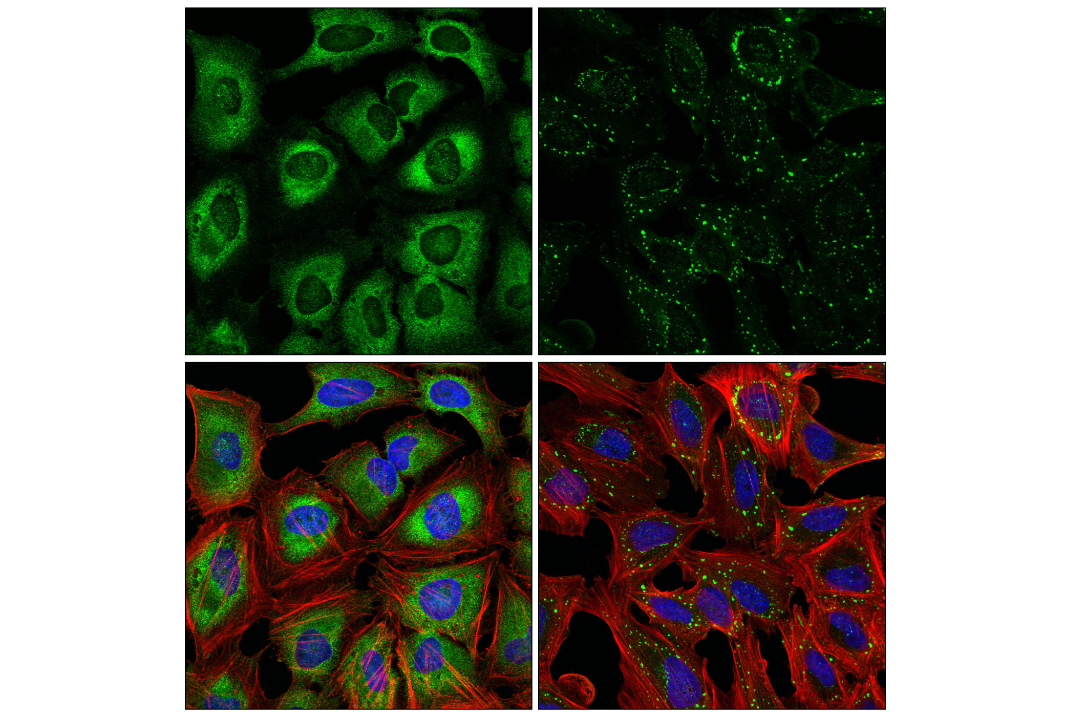 Immunofluorescence Image 5: YTHDF3 (E2J9I) Rabbit mAb