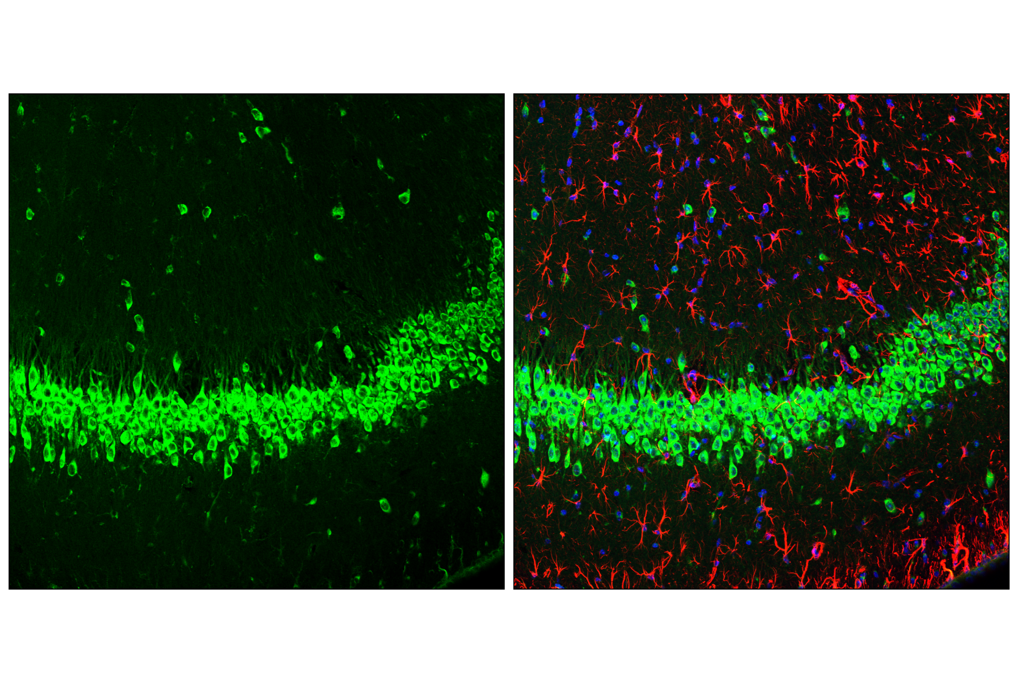 Immunofluorescence Image 3: YTHDF3 (E2J9I) Rabbit mAb