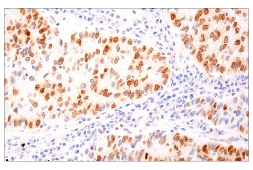 Immunohistochemistry Image 1: Phospho-Histone H2A.X (Ser139) (D7T2V) Mouse mAb