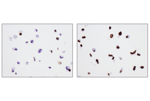 Immunohistochemistry Image 5: Phospho-Histone H2A.X (Ser139) (D7T2V) Mouse mAb