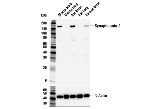 Western Blotting Image 1: Synaptojanin-1 Antibody