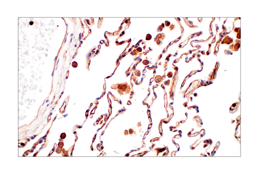 Immunohistochemistry Image 9: Phospho-Tyrosine Mouse mAb (P-Tyr-100) (BSA and Azide Free)