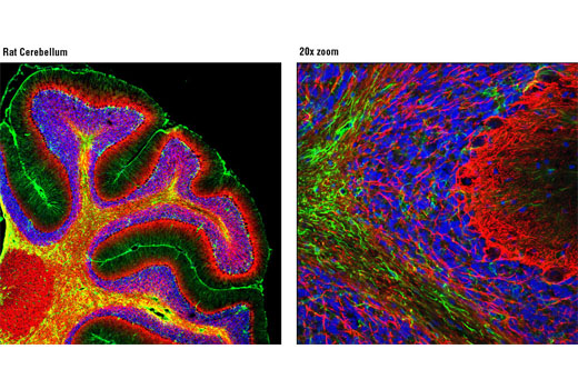 Immunofluorescence Image 1: Neurofilament-L (C28E10) Rabbit mAb (Alexa Fluor® 555 Conjugate)