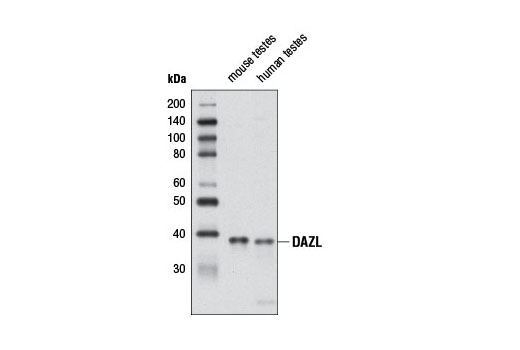 Western Blotting Image 1: DAZL Antibody