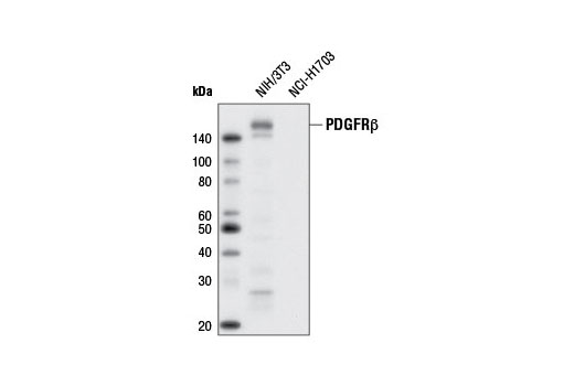 Western Blotting Image 1: PDGF Receptor β (28E1) Rabbit mAb (Biotinylated)