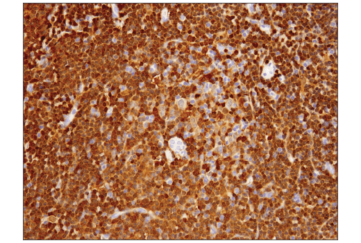Immunohistochemistry Image 3: Syk (4D10) Mouse mAb