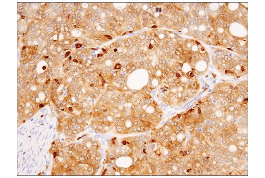 Immunohistochemistry Image 4: Syk (4D10) Mouse mAb