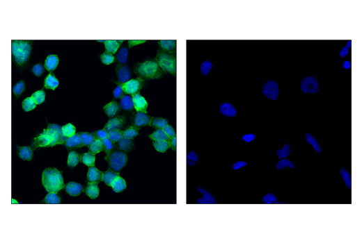 Immunofluorescence Image 1: Syk (4D10) Mouse mAb