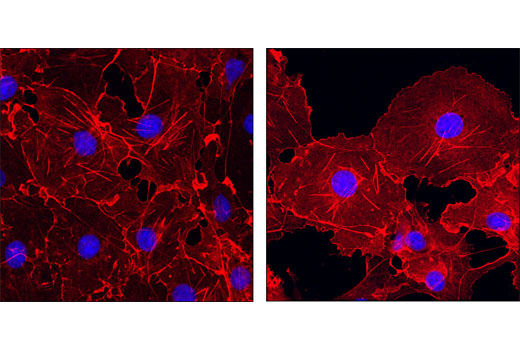 Immunofluorescence Image 1: β-Actin (13E5) Rabbit mAb (Alexa Fluor®555 Conjugate)