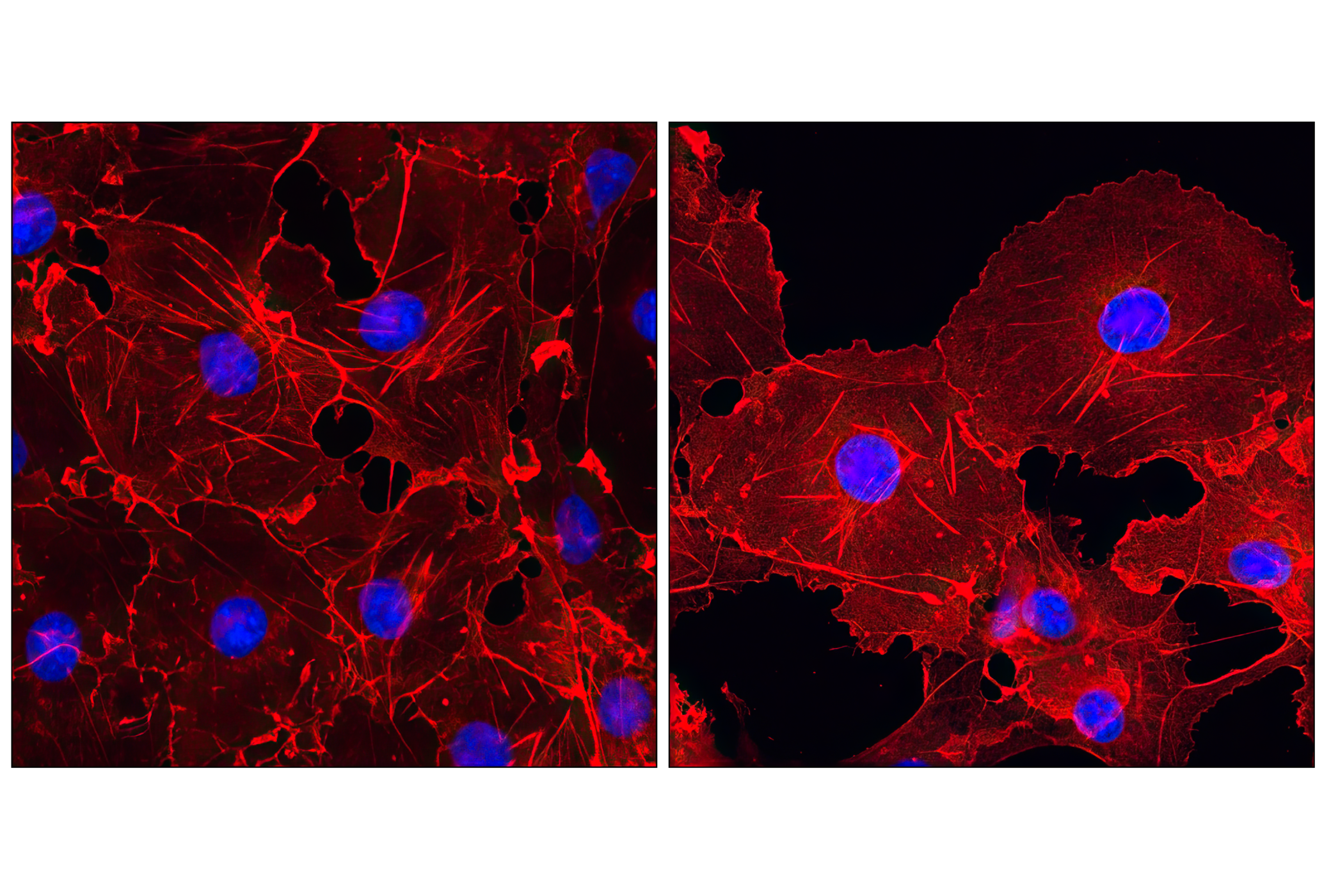 Immunofluorescence Image 1: β-Actin (13E5) Rabbit mAb (Alexa Fluor® 555 Conjugate)