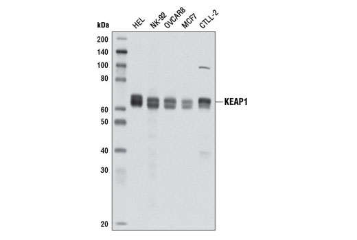  Image 10: p62/KEAP1/NRF2 Pathway Antibody Sampler Kit