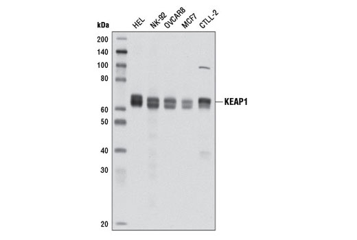 undefined Image 10: p62/KEAP1/NRF2 Pathway Antibody Sampler Kit