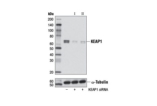  Image 17: p62/KEAP1/NRF2 Pathway Antibody Sampler Kit