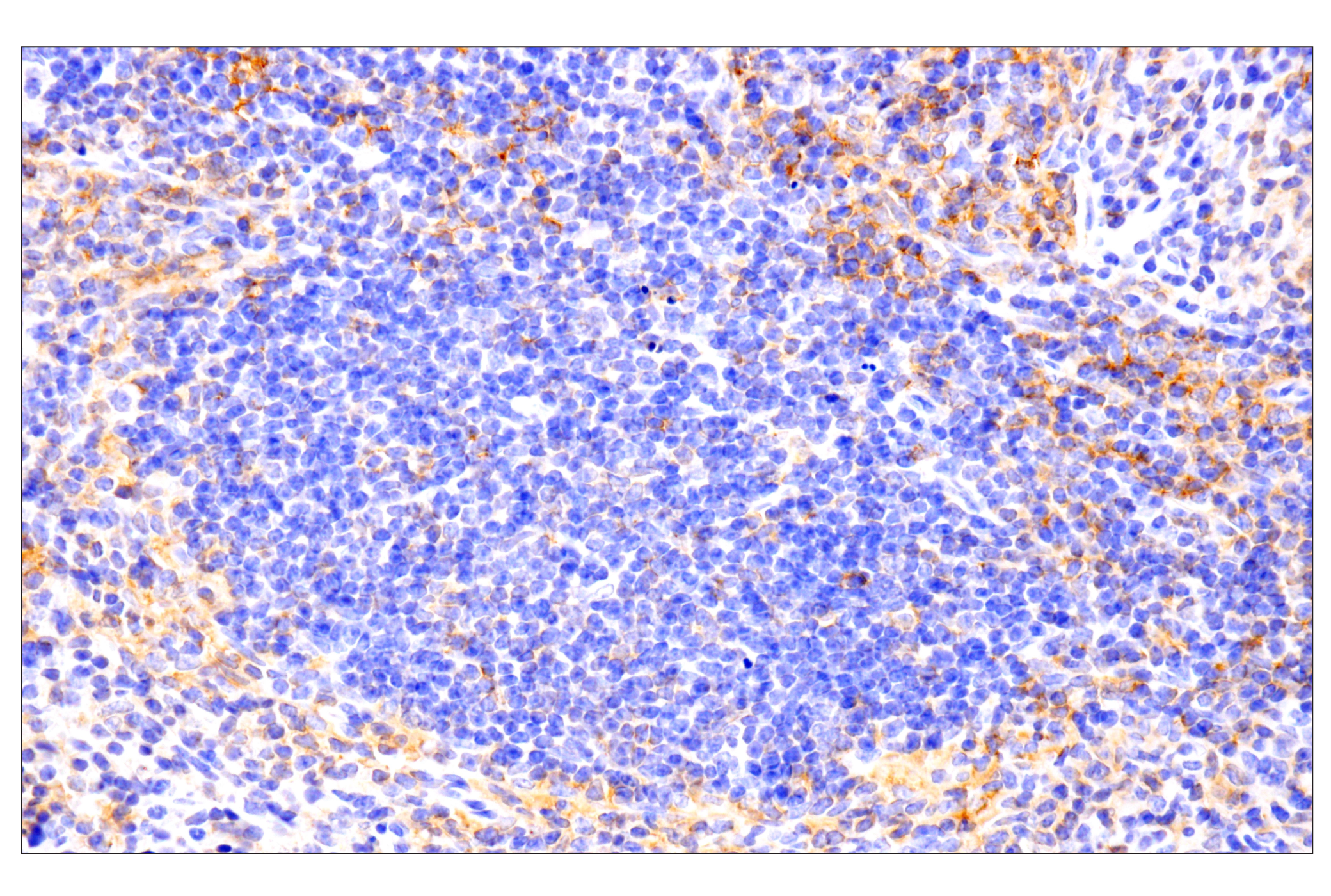 Immunohistochemistry Image 3: PD-L1 (F3Z1T) Rabbit Monoclonal Antibody (IHC Formulated)