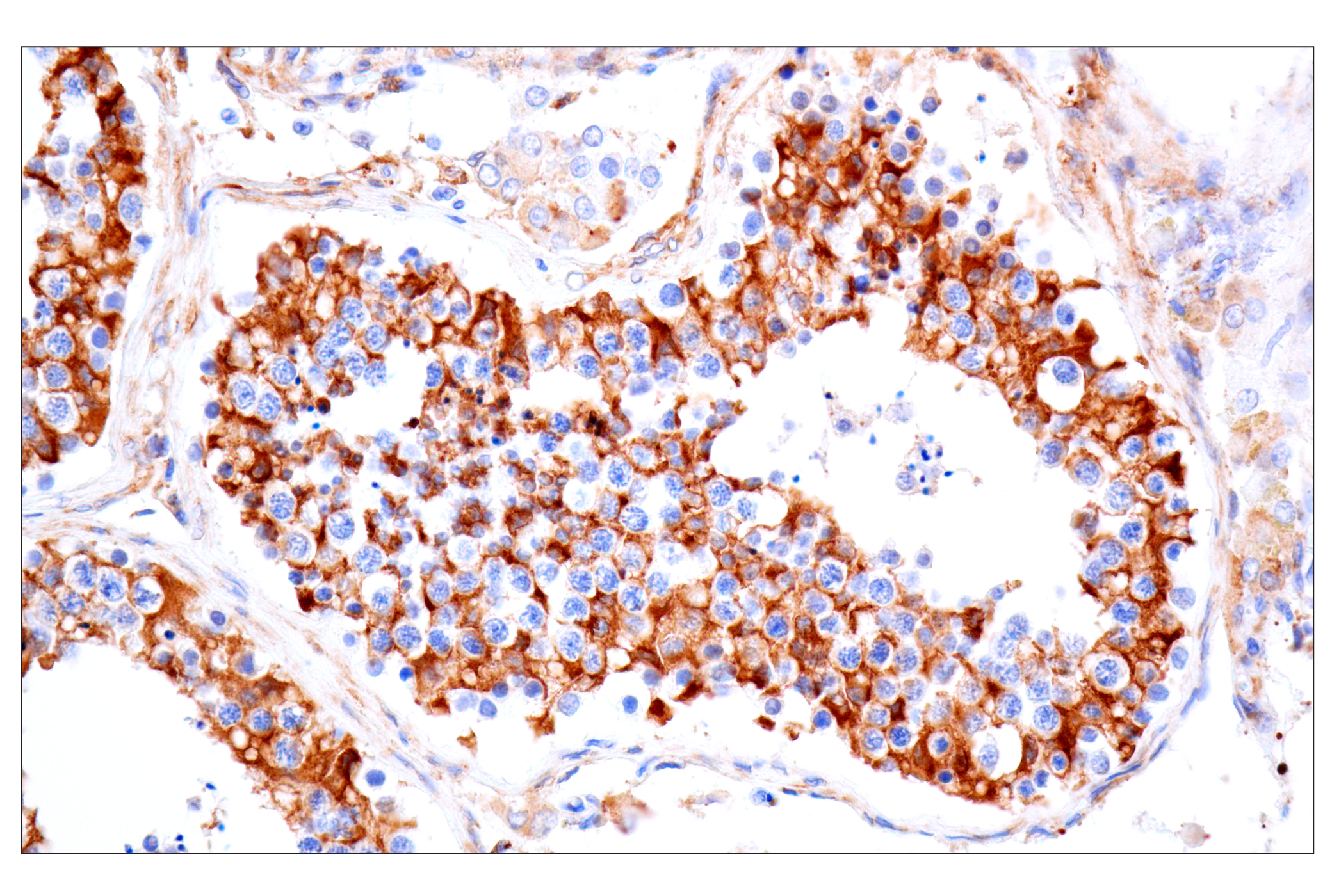 Immunohistochemistry Image 15: MAP1B (E8S8R) Rabbit mAb (IF Formulated)