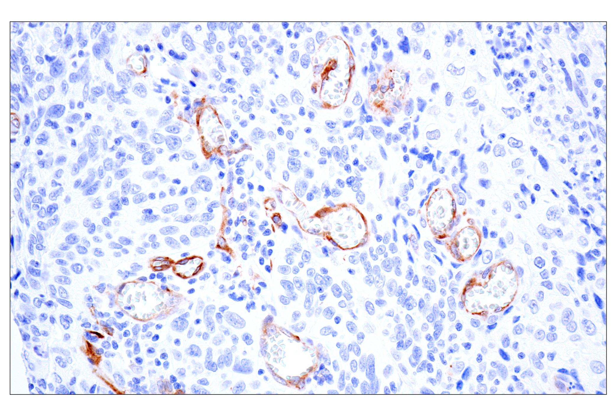 Immunohistochemistry Image 6: MAP1B (E8S8R) Rabbit mAb (IF Formulated)