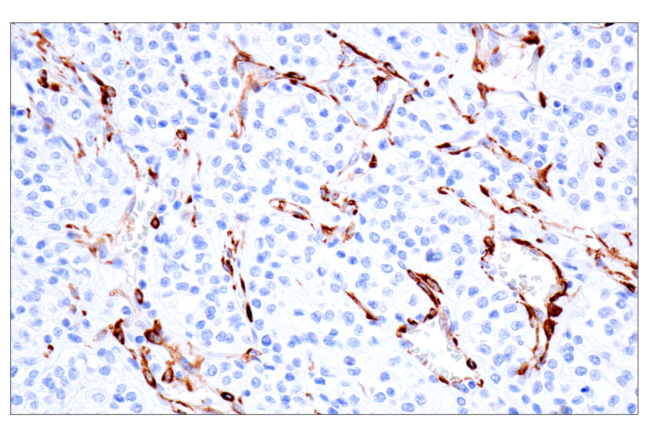 Immunohistochemistry Image 3: MAP1B (E8S8R) Rabbit mAb (IF Formulated)