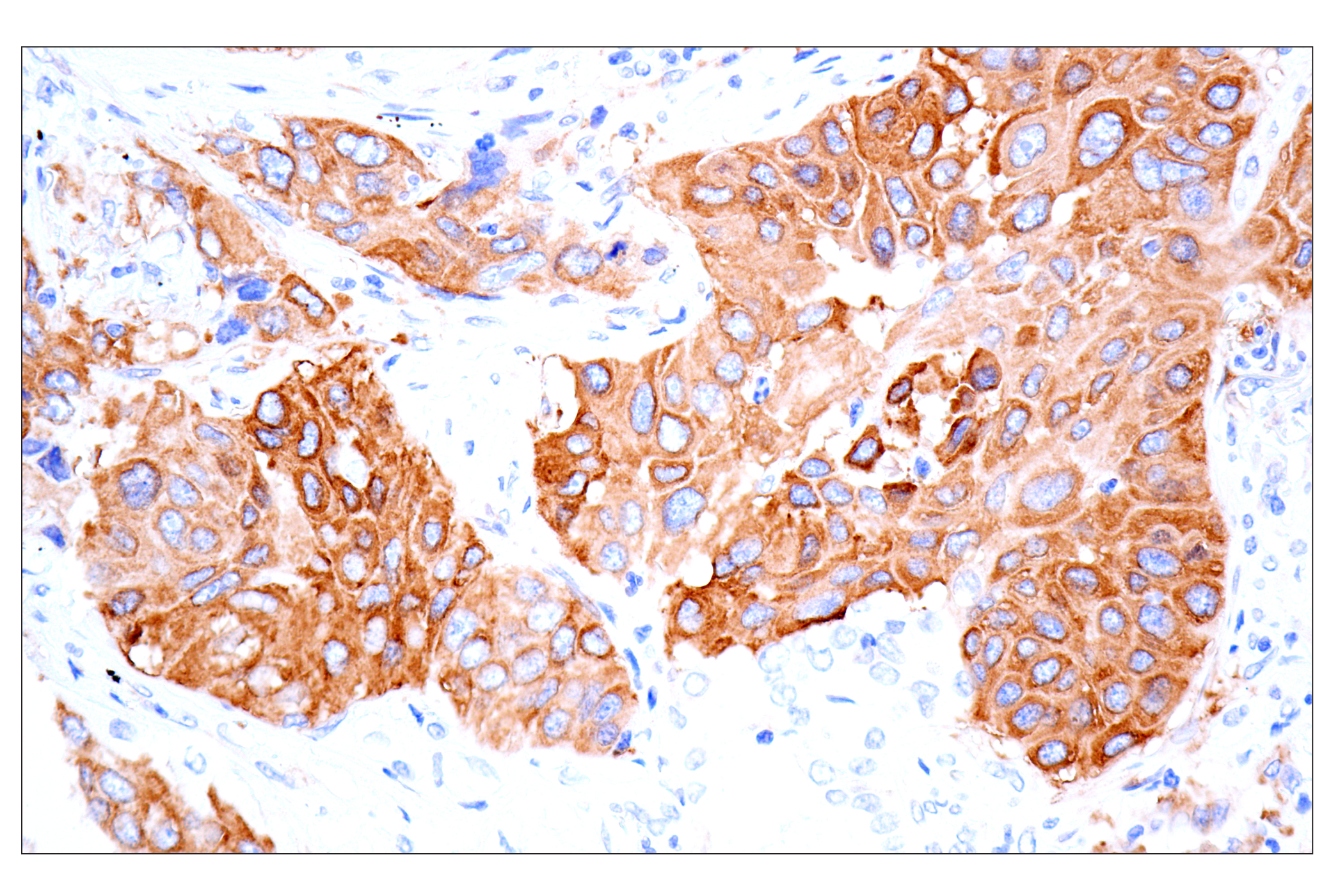 Immunohistochemistry Image 1: MAP1B (E8S8R) Rabbit mAb (IF Formulated)