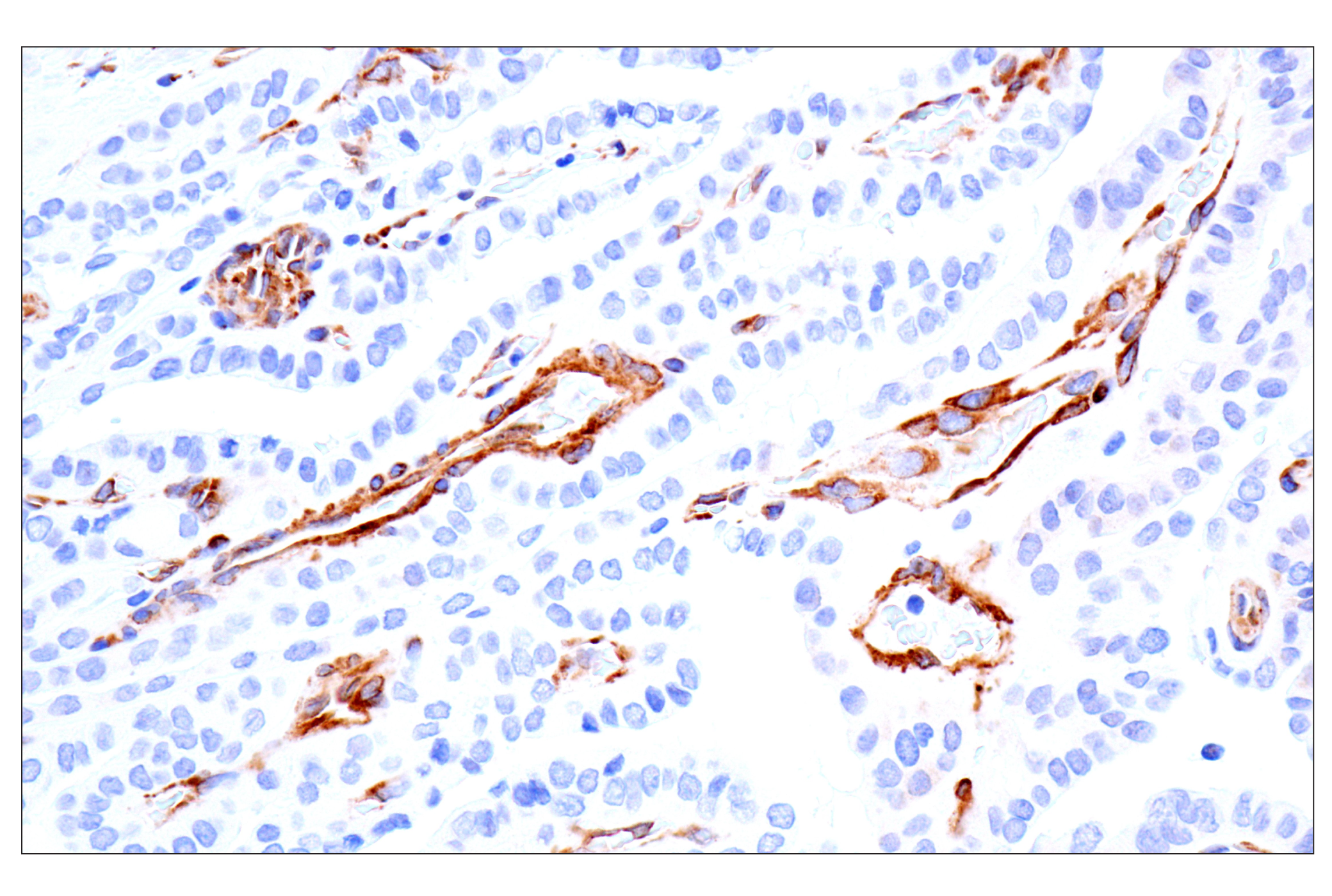 Immunohistochemistry Image 8: MAP1B (E8S8R) Rabbit mAb (IF Formulated)