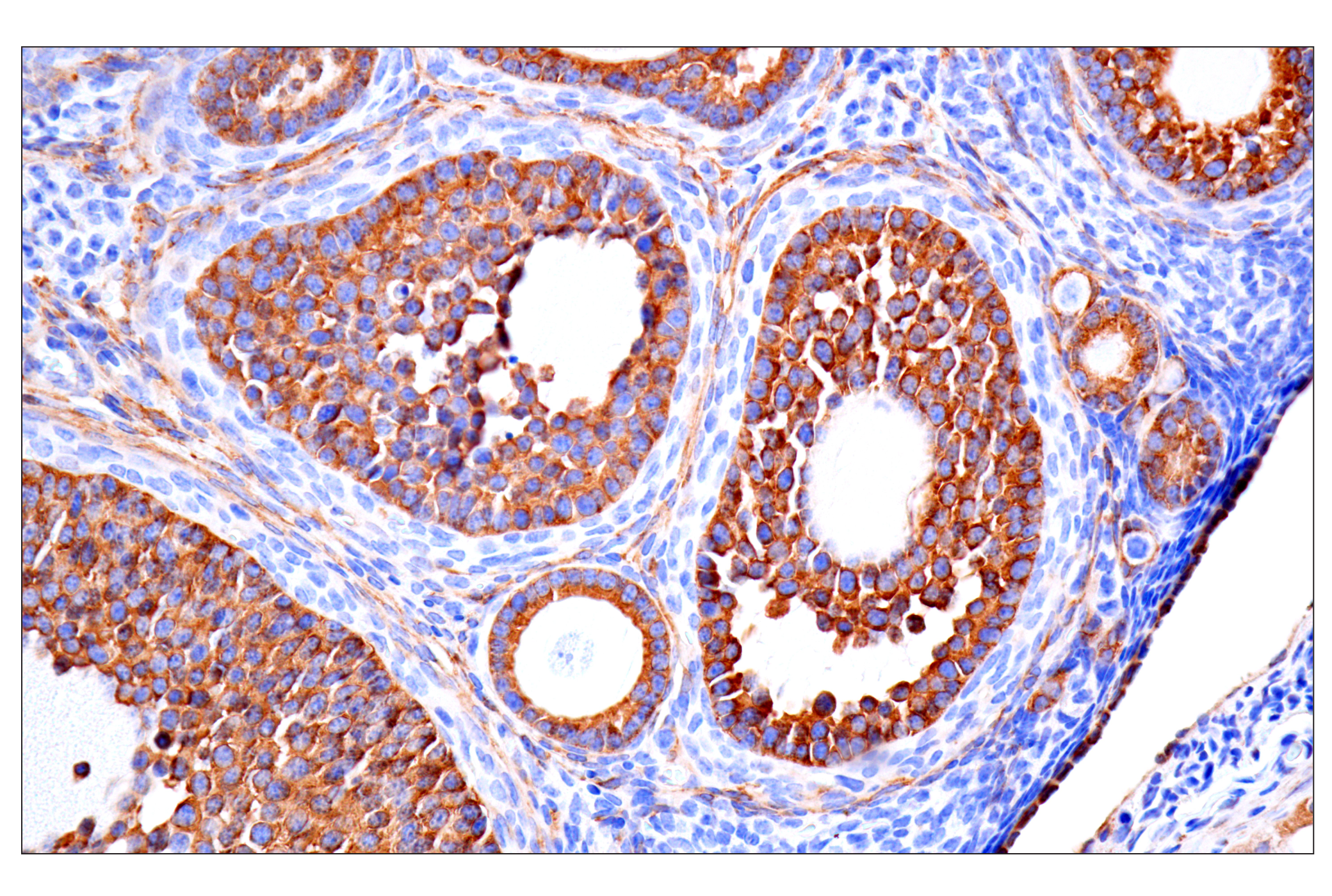 Immunohistochemistry Image 21: MAP1B (E8S8R) Rabbit mAb (IF Formulated)