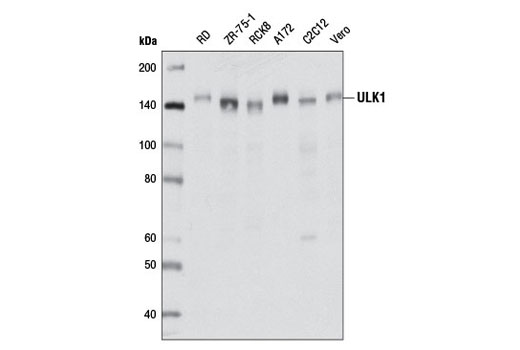  Image 15: Autophagy Induction (ULK1 Complex) Antibody Sampler Kit