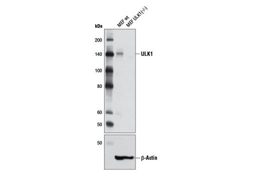  Image 13: Autophagy Induction (ULK1 Complex) Antibody Sampler Kit