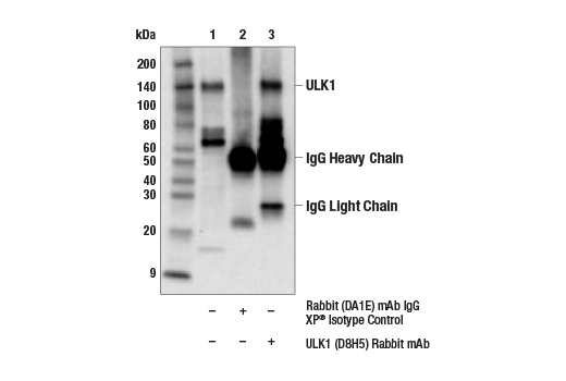 Immunoprecipitation Image 1: ULK1 (D8H5) Rabbit mAb