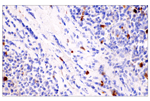 Immunohistochemistry Image 3: Parvalbumin (E8N2U) XP® Rabbit mAb